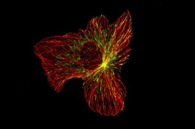 Interdyscyplinarne badania po raz pierwszy pomagają ujawnić przebieg ruchu włókien komórki